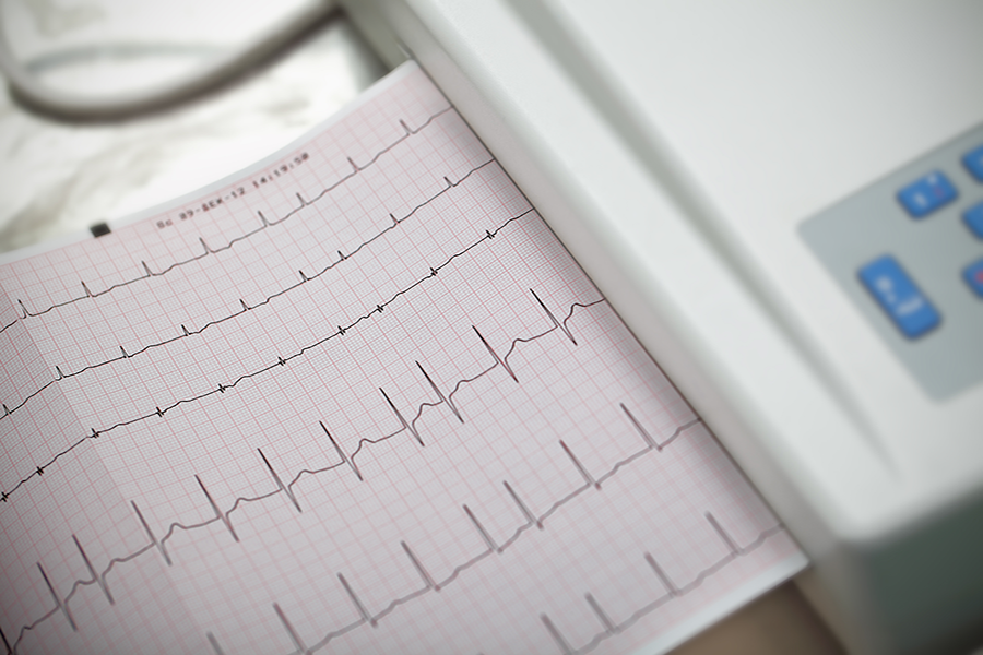 Don't Skip a Beat When Managing Atrial Fibrillation